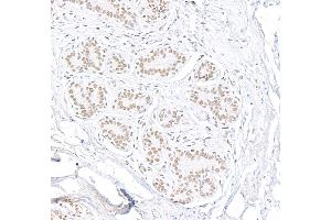 anti-Heterogeneous Nuclear Ribonucleoprotein U-Like 1 (HNRNPUL1) (C-Term) antibody