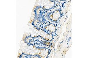Immunohistochemistry (Paraffin-embedded Sections) (IHC (p)) image for anti-CUB Domain Containing Protein 1 (CDCP1) antibody (ABIN7073600)