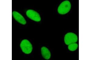 Immunofluorescence of purified MaxPab antibody to SAE1 on HeLa cell. (SAE1 抗体  (AA 1-346))