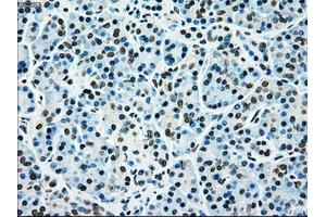 Immunohistochemical staining of paraffin-embedded liver tissue using anti-MAP2K4mouse monoclonal antibody. (MAP2K4 抗体)