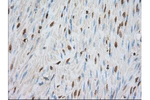 Immunohistochemical staining of paraffin-embedded liver tissue using anti-PDE4A mouse monoclonal antibody. (PDE4A 抗体)