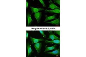 Immunofluorescence (IF) image for anti-Calcium/calmodulin-Dependent Protein Kinase ID (CAMK1D) antibody (ABIN2856619)