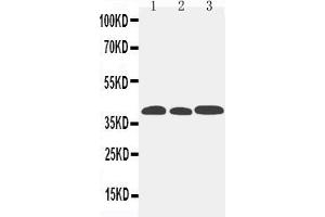 Anti-CCR5 antibody, Western blotting Lane 1: Mouse Lung Tissue Lysate Lane 2: Mouse Intestine Tissue Lysate Lane 3: Mouse Kidney Tissue Lysate
