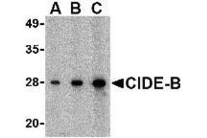 Western blot analysis of CIDE-B in mouse small intestine tissue lysate with AP30232PU-N CIDE-B antibody at (A) 0. (CIDEB 抗体  (C-Term))