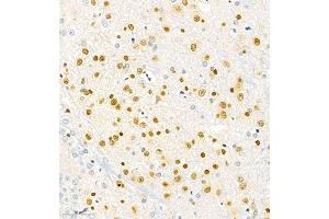 Immunohistochemistry of paraffin embedded rat brain using SOX1 (ABIN7075712) at dilution of 1:2000 (300x lens) (SOX1 抗体)
