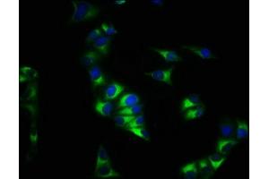Immunofluorescence staining of Hela cells with ABIN7146107 at 1:200, counter-stained with DAPI. (CXCR4 抗体  (AA 1-356))