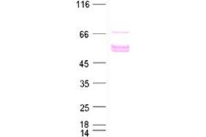 Western Blotting (WB) image for Estrogen Receptor 2 (ESR2) protein (DYKDDDDK Tag) (ABIN2720542)