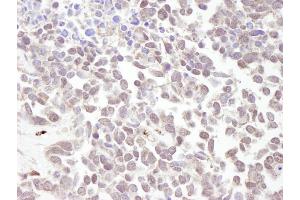 Immunohistochemistry (IHC) image for anti-Metastasis Associated 1 (MTA1) (AA 400-450) antibody (ABIN7448676) (MTA1 抗体  (AA 400-450))