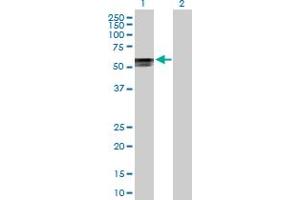 Western Blotting (WB) image for anti-Polymerase (RNA) III (DNA Directed) Polypeptide D, 44kDa (POLR3D) (AA 1-398) antibody (ABIN513789)