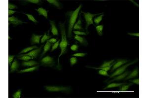 Immunofluorescence of purified MaxPab antibody to MTA1 on HeLa cell. (MTA1 抗体  (AA 1-255))