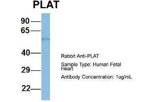 Host: Rabbit  Target Name: PLAT  Sample Tissue: Human Fetal Heart  Antibody Dilution: 1. (PLAT 抗体  (Middle Region))
