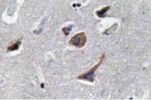 Immunohistochemistry (IHC) analyzes of IL-12A antibody in paraffin-embedded human brain tissue. (IL12A 抗体)
