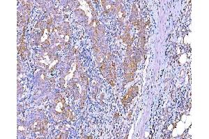 IHC analysis of RALBP1 using anti-RALBP1 antibody (ABIN7600800). (RALBP1 抗体  (AA 239-506))