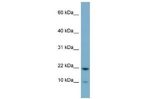 D15WSU75E antibody used at 1 ug/ml to detect target protein.