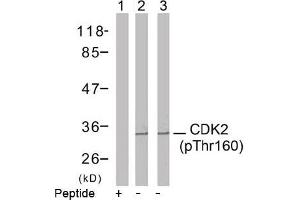 Image no. 2 for anti-Cyclin-Dependent Kinase 2 (CDK2) (pThr160) antibody (ABIN196844) (CDK2 抗体  (pThr160))