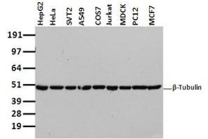 Image no. 2 for anti-Tubulin beta 4a (TUBB4A) antibody (ABIN1501580) (TUBB4 抗体)