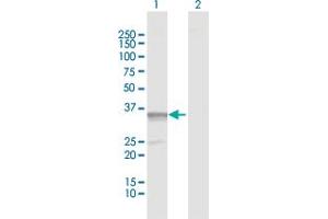 Western Blot analysis of PDXK expression in transfected 293T cell line by PDXK MaxPab polyclonal antibody. (PDXK 抗体  (AA 1-312))