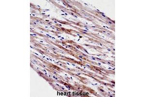 Immunohistochemistry (IHC) image for anti-Cardiotrophin 1 (CTF1) antibody (ABIN2998336) (Cardiotrophin 1 抗体)
