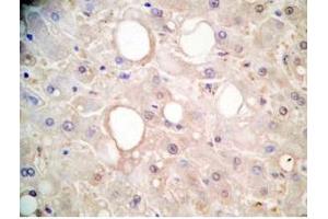 Human liver tissue was stained by Rabbit Anti-FGF-21 (26-47) (H) Antibody (FGF21 抗体  (AA 26-47))