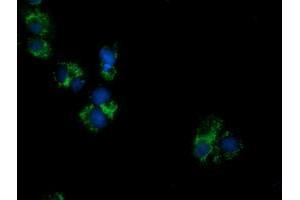 Anti-PECR mouse monoclonal antibody (ABIN2453444) immunofluorescent staining of COS7 cells transiently transfected by pCMV6-ENTRY PECR (RC200822). (PECR 抗体)