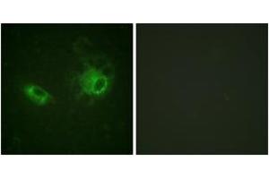 Immunofluorescence analysis of HeLa cells, using PDGFRB (Ab-1009) Antibody. (PDGFRB 抗体  (AA 981-1030))