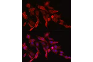 Immunofluorescence analysis of PC-12 cells using ASNS Rabbit pAb (ABIN6127372, ABIN6137209, ABIN6137210 and ABIN6221207) at dilution of 1:50 (40x lens).