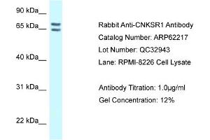 Western Blotting (WB) image for anti-Connector Enhancer of Kinase Suppressor of Ras 1 (CNKSR1) (C-Term) antibody (ABIN2789066) (CNKSR1 抗体  (C-Term))
