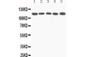 Western Blotting (WB) image for anti-Complement Component 5 (C5) (AA 1-18), (N-Term) antibody (ABIN3044294)