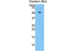 WB of Protein Standard: different control antibodies  against Highly purified E. (ANGPTL3 ELISA 试剂盒)