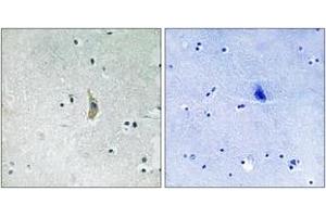 Immunohistochemistry analysis of paraffin-embedded human brain tissue, using PSEN1 (Ab-357) Antibody. (Presenilin 1 抗体  (AA 323-372))