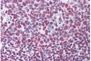 Immunohistochemistry (Formalin-fixed Paraffin-embedded Sections) (IHC (fp)) image for anti-KH-Type Splicing Regulatory Protein (KHSRP) (AA 151-240) antibody (ABIN574396)