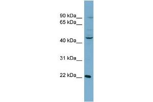 WB Suggested Anti-GOT1 AntibodyTitration: 1 µg/mL  Positive Control: NCI-H226 Whole Cell  GOT1 is supported by BioGPS gene expression data to be expressed in NCIH226 (GOT1 抗体  (N-Term))