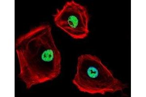 Fluorescent confocal image of SK-BR-3 cells stained with CTBP1 antibody. (CTBP1 抗体  (AA 413-440))