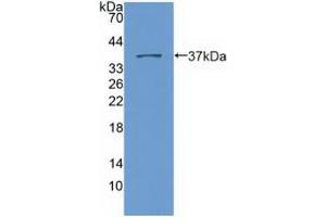 Western blot analysis of recombinant Human Nesp2. (SYNE2 抗体  (AA 6-296))