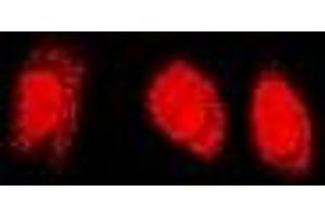 Immunofluorescent analysis of PSMC4 staining in U2OS cells. (PSMC4 抗体)