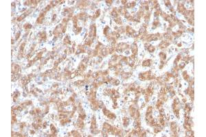 Immunohistochemistry (IHC) image for anti-Complement Component 1, Q Subcomponent, A Chain (C1QA) (AA 104-237) antibody (ABIN6940765)