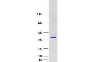 Western Blotting (WB) image for Syntaxin 2 (STX2) (Transcript Variant 2) protein (Myc-DYKDDDDK Tag) (ABIN2733110)