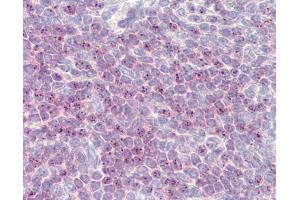 Anti-DLL1 antibody IHC of human spleen. (DLL1 抗体  (AA 640-700))