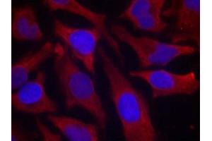 Immunofluorescence staining of methanol-fixed Hela cells using synapsin(Phospho-Ser9) Antibody. (SYN1 抗体  (pSer9))