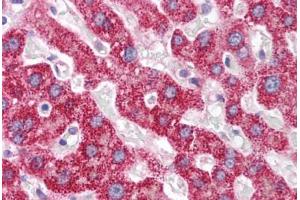 Human Liver (formalin-fixed, paraffin-embedded) stained with PCK1 antibody ABIN214134 at 5 ug/ml followed by biotinylated goat anti-rabbit IgG secondary antibody ABIN481713, alkaline phosphatase-streptavidin and chromogen. (PCK1 抗体  (AA 330-379))
