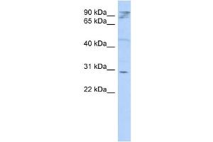 WB Suggested Anti-HAX1 Antibody Titration: 0. (HAX1 抗体  (Middle Region))