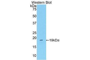 Western Blotting (WB) image for anti-Mannose Associated Serine Protease 2 (AA 280-433) antibody (ABIN1859764) (Mannose Associated Serine Protease 2 (AA 280-433) 抗体)