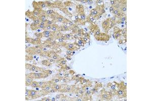 Immunohistochemistry (Paraffin-embedded Sections) (IHC (p)) image for anti-Cerebral Cavernous Malformation 2 (CCM2) (AA 1-300) antibody (ABIN6138069)