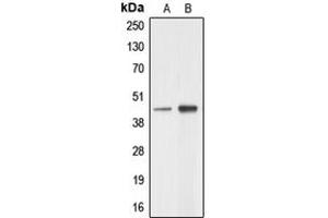 Western blot analysis of AARSD1 expression in A549 (A), HeLa (B) whole cell lysates. (AARSD1 抗体  (Center))