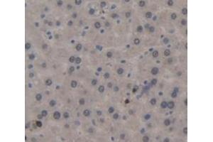 IHC-P analysis of Rat Tissue, with DAB staining. (CD11b 抗体  (AA 31-160))