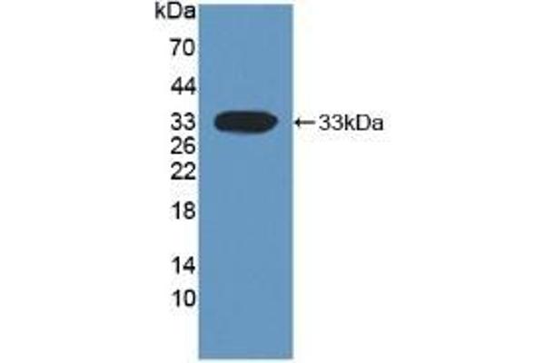 DKK1 抗体  (AA 33-266)