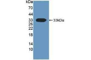 Detection of Recombinant DKK1, Human using Monoclonal Antibody to Dickkopf Related Protein 1 (DKK1) (DKK1 抗体  (AA 33-266))