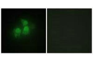 Immunofluorescence analysis of HepG2 cells, using IPPK antibody. (IPPK 抗体)