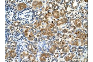 Immunohistochemistry (IHC) image for anti-Cystatin B (Stefin B) (CSTB) (Middle Region) antibody (ABIN2782349) (CSTB 抗体  (Middle Region))