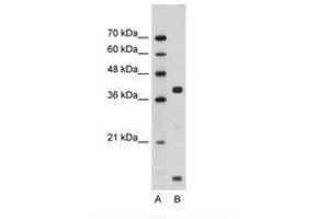 Image no. 1 for anti-FXYD Domain Containing Ion Transport Regulator 5 (FXYD5) (AA 66-115) antibody (ABIN203357) (FXYD5 抗体  (AA 66-115))